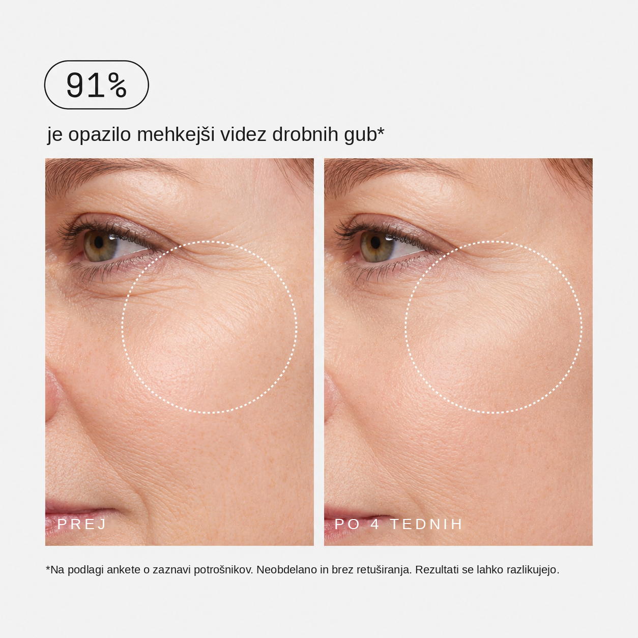 Retinalni učvrstitveni serum