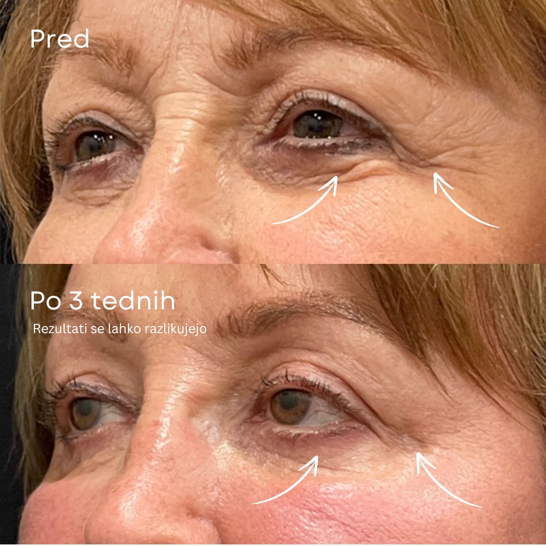 24K Zlati Serum proti staranju