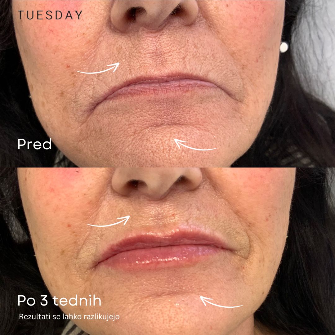 24K Zlati Serum proti staranju