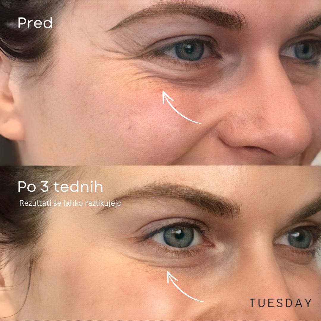 GlowLift Retinol Stick za Oči