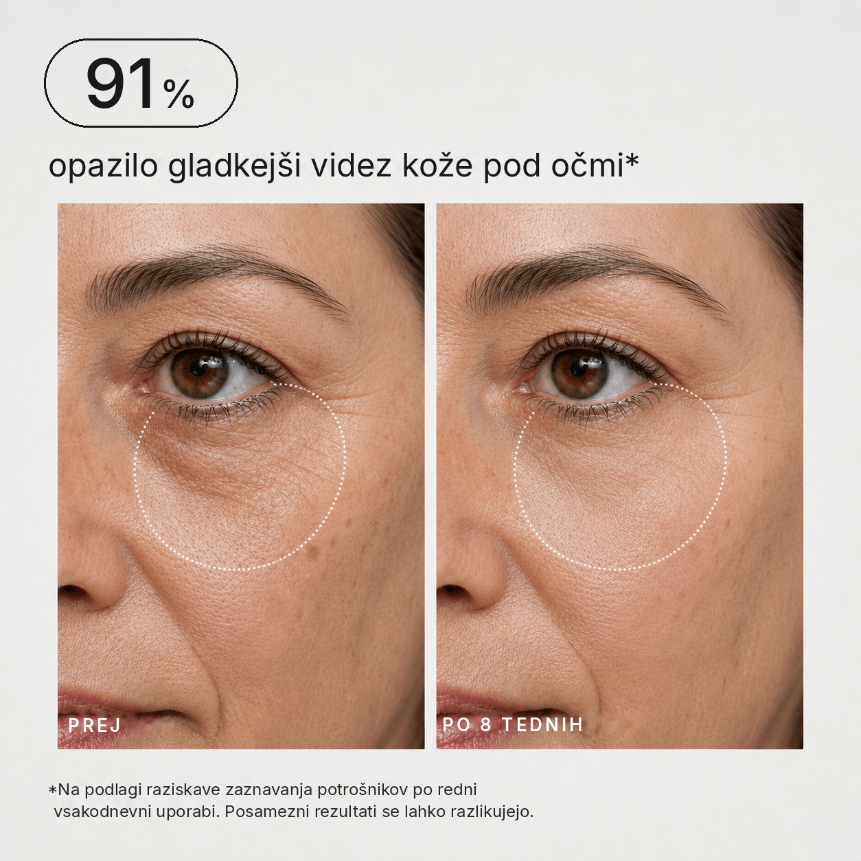PDRN Kolagenski balzam za polnejši videz kože