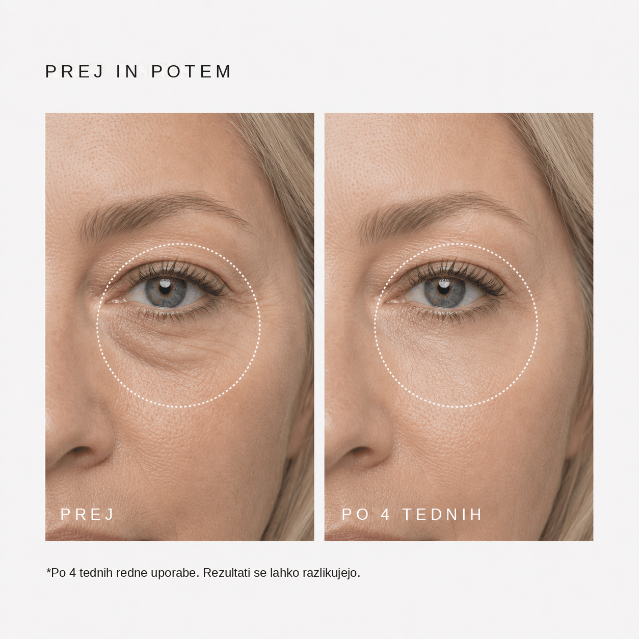 GlowLift retinolni očesni stik